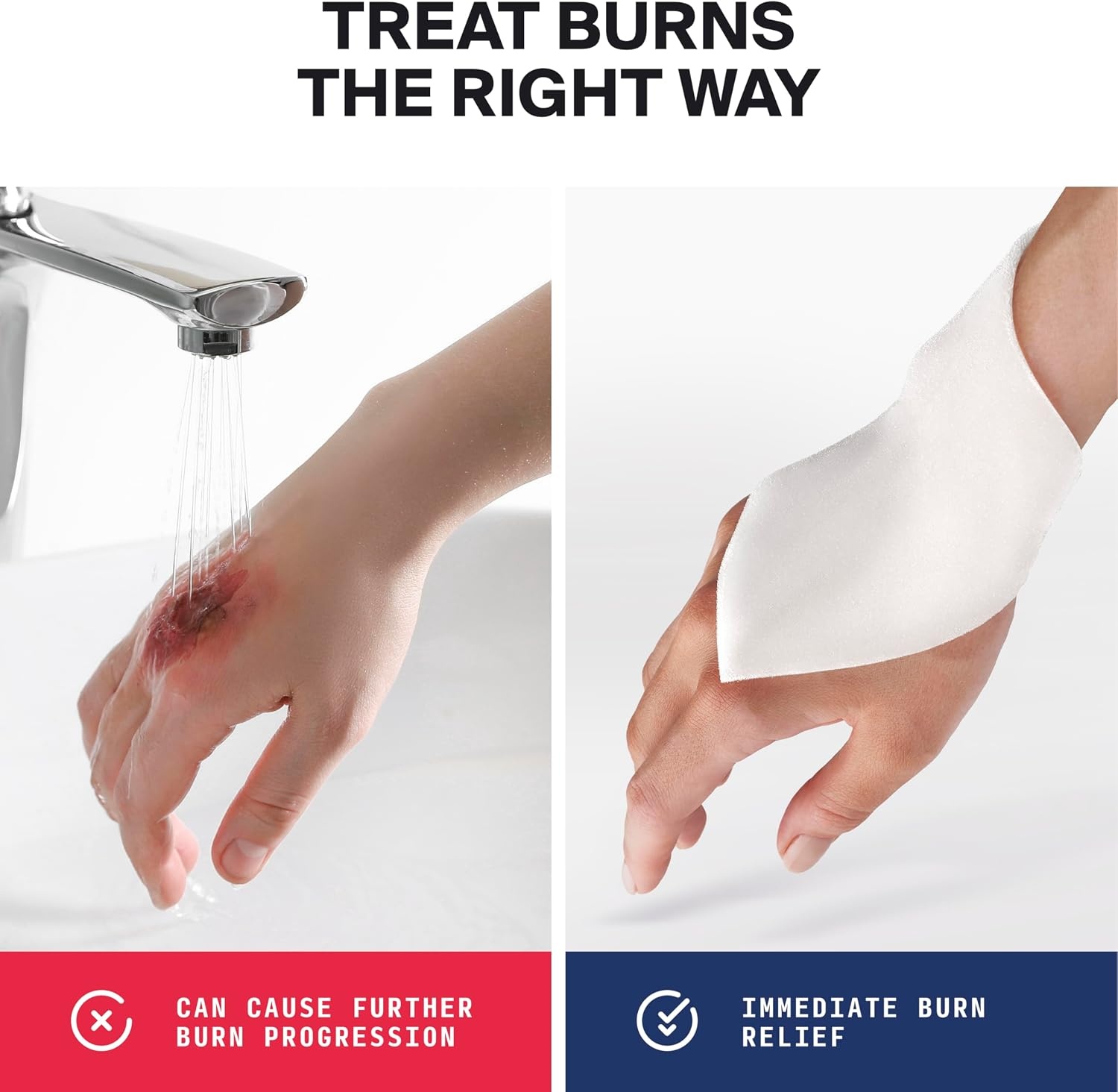 image:imageSurviveX Burn Dressing Kit with Tea Tree Oil Hydrogel Burn Pads Cooling Gels NonAdhesive Dressings amp Gauze Complete First Aid Accessory for Instant Cooling Soothing amp Burn ReliefKit