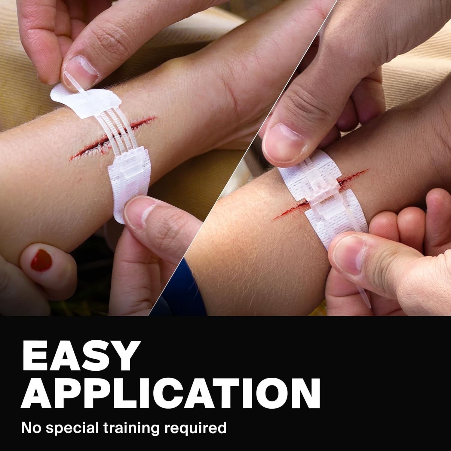 image:imageSurviveX Zip Stitch Wound Closure Strips First aid Kit Repair Wounds Without Stitches Zipstitch Sutures Laceration Closures 3 PCS3 PCS